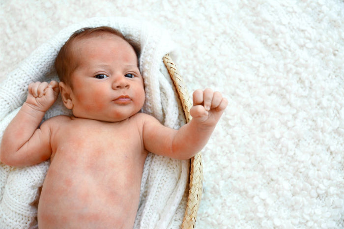 From Eczema to Asthma: What Every Mama Should Know About the Atopic March
